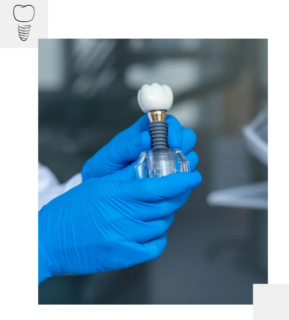 Single Dental Implants in Mackay