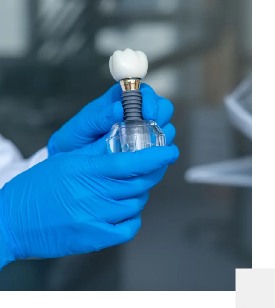Single tooth implant in Mackay