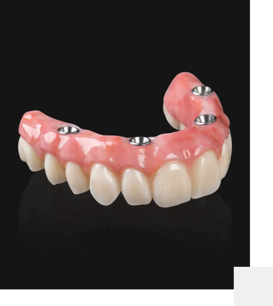 Full arch dental implants in Mackay